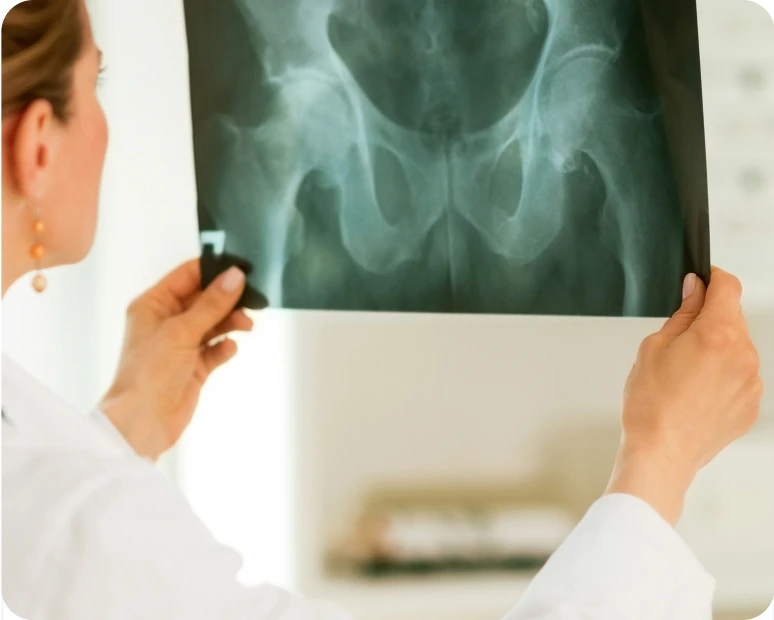 Radiography Role
